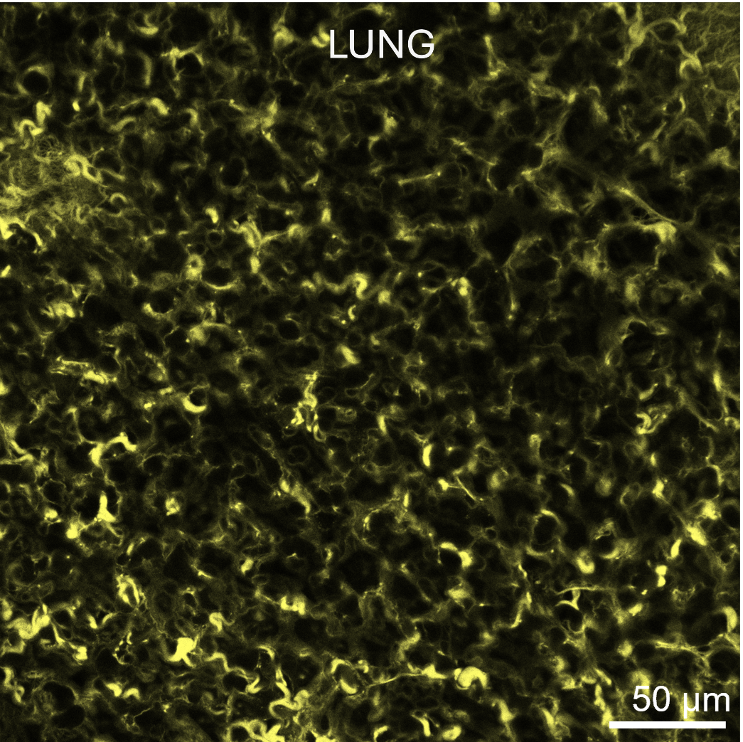 Use of Rhobo6 ECM Dye for labeling the extracellular matrix (ECM) in live lung tissues.